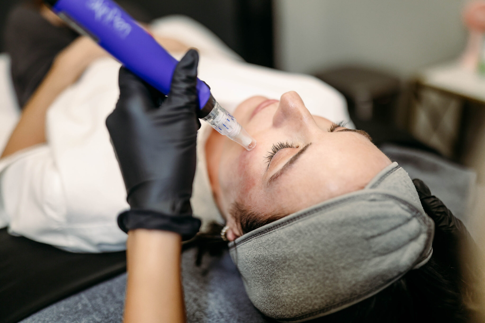 skinpen microneedling